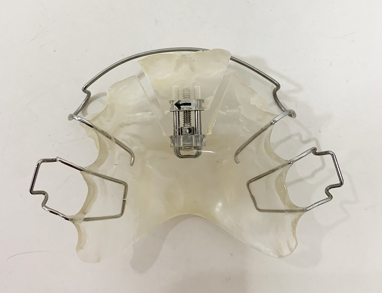 八千代緑が丘駅より徒歩1分の歯医者、公園都市プラザわかば歯科の矯正歯科