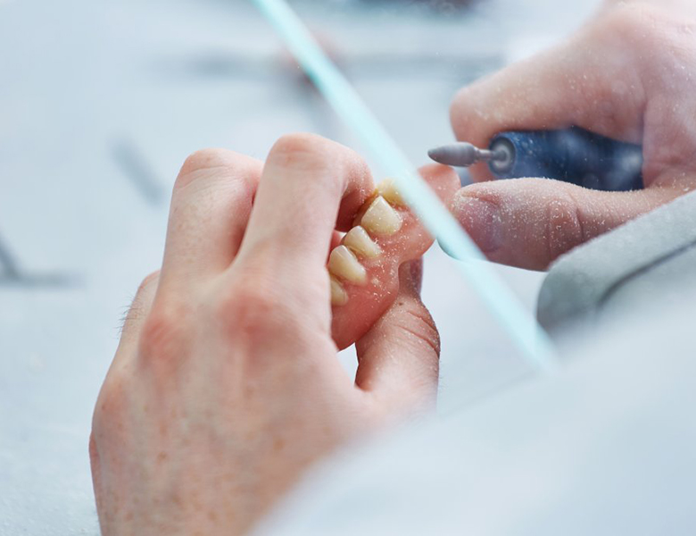 金沢文庫（横浜市金沢区）の歯医者、桜井歯科医院の入れ歯治療