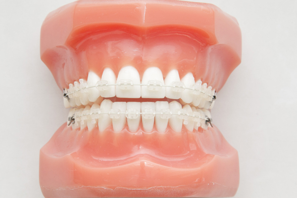 金沢文庫（横浜市金沢区）の歯医者、桜井歯科医院の矯正歯科