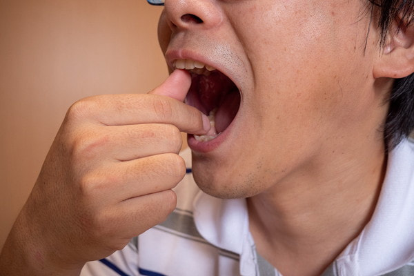 金沢文庫（横浜市金沢区）の歯医者、桜井歯科医院の顎関節症