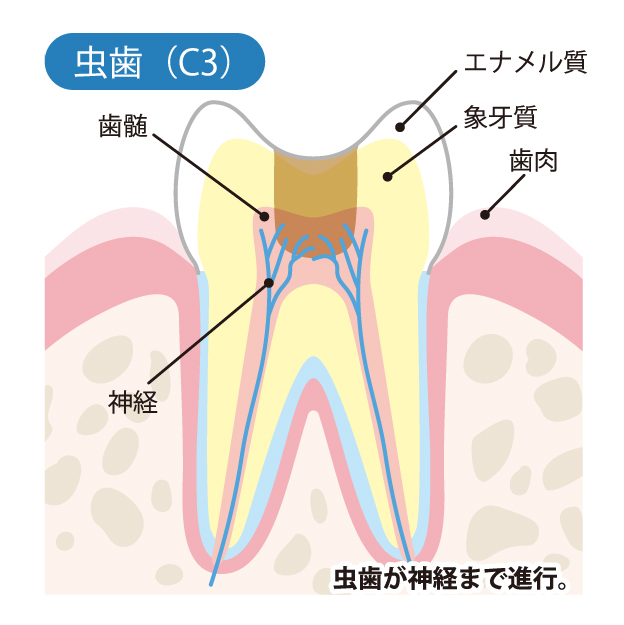  八千代緑が丘駅より徒歩1分の歯医者、公園都市プラザわかば歯科のなるべく削らず、歯を守る治療