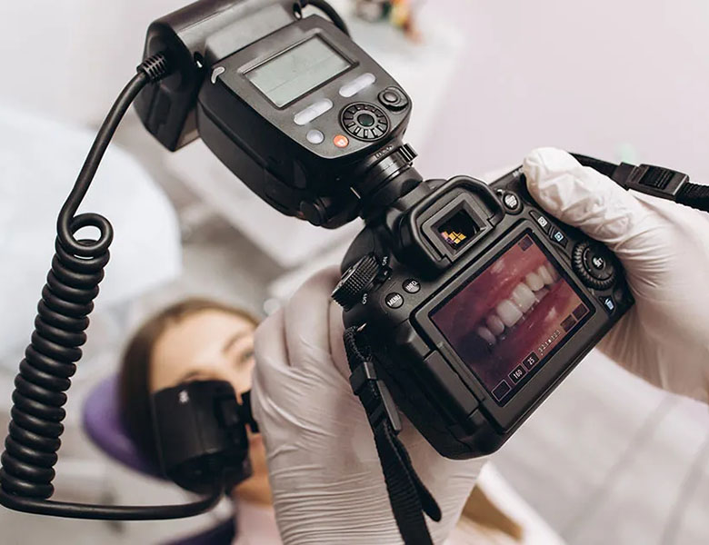 金沢文庫（横浜市金沢区）の歯医者、桜井歯科医院のホワイトニング