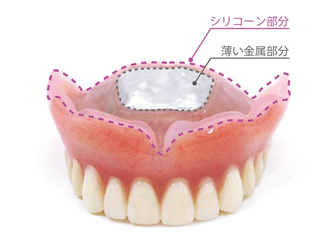 金沢文庫（横浜市金沢区）の歯医者、桜井歯科医院の入れ歯治療