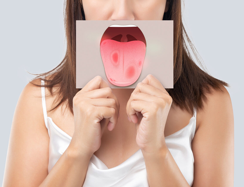 金沢文庫（横浜市金沢区）の歯医者、桜井歯科医院のお口の中のデキモノ