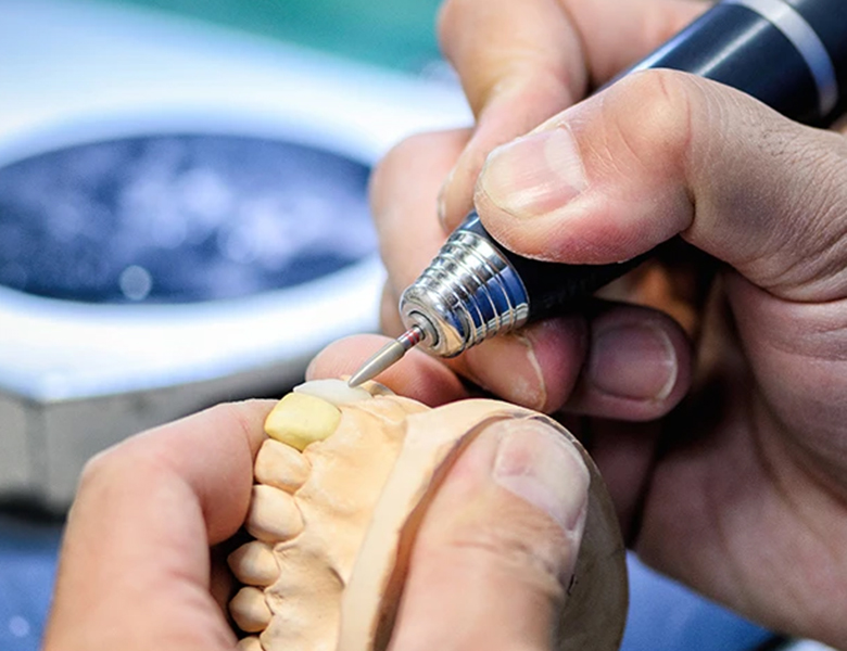 金沢文庫（横浜市金沢区）の歯医者、桜井歯科医院の審美歯科