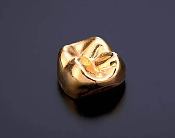 金沢文庫（横浜市金沢区）の歯医者、桜井歯科医院の審美歯科