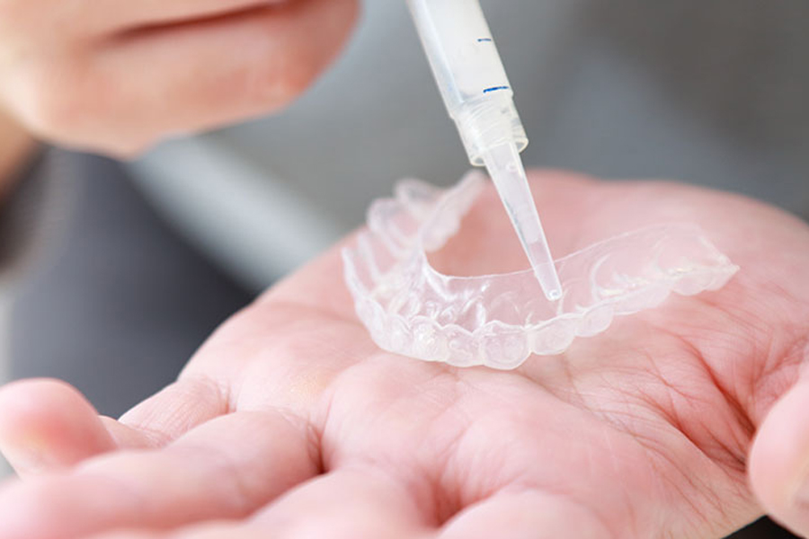 八千代緑が丘駅より徒歩1分の歯医者、公園都市プラザわかば歯科のホワイトニング