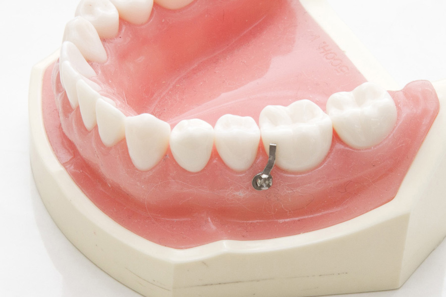 八千代緑が丘駅より徒歩1分の歯医者、公園都市プラザわかば歯科の矯正歯科