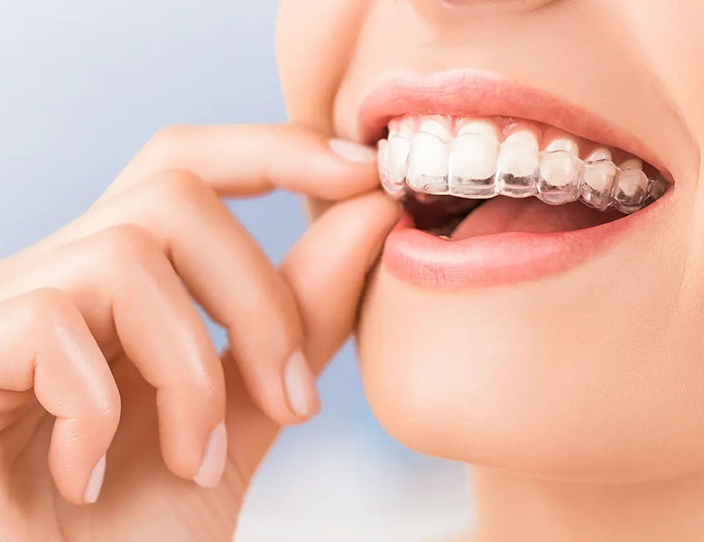 金沢文庫（横浜市金沢区）の歯医者、桜井歯科医院の矯正歯科