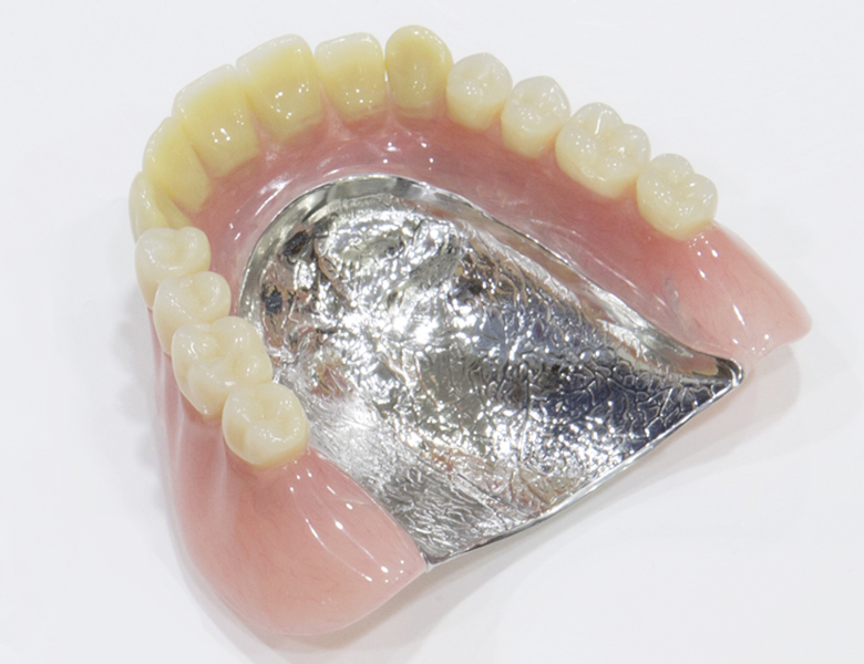 金沢文庫（横浜市金沢区）の歯医者、桜井歯科医院の入れ歯治療