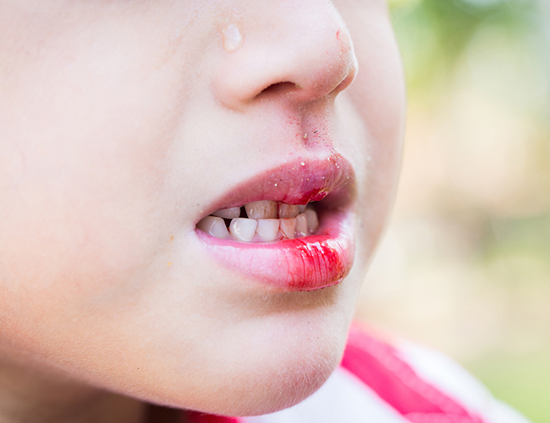 金沢文庫（横浜市金沢区）の歯医者、桜井歯科医院の口腔外科