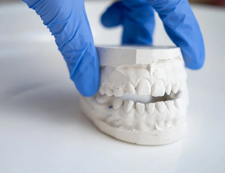 金沢文庫（横浜市金沢区）の歯医者、桜井歯科医院のむし歯治療