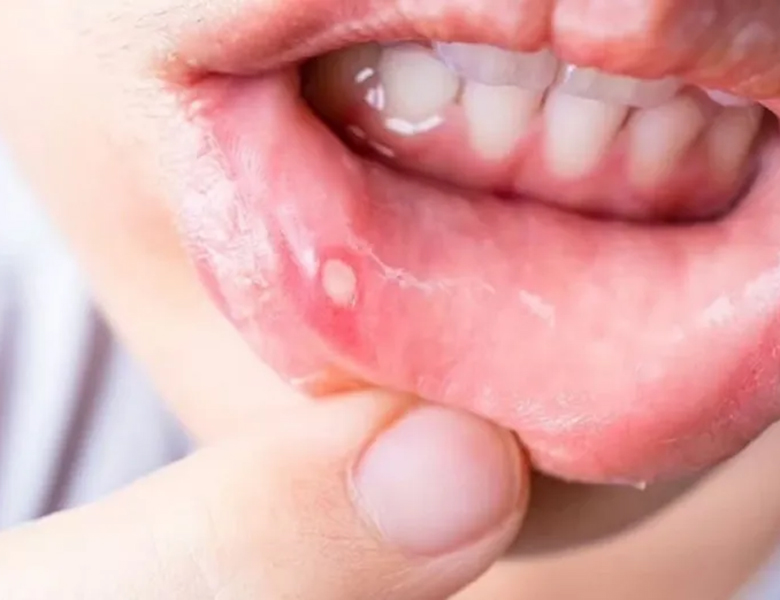 金沢文庫（横浜市金沢区）の歯医者、桜井歯科医院の口腔外科