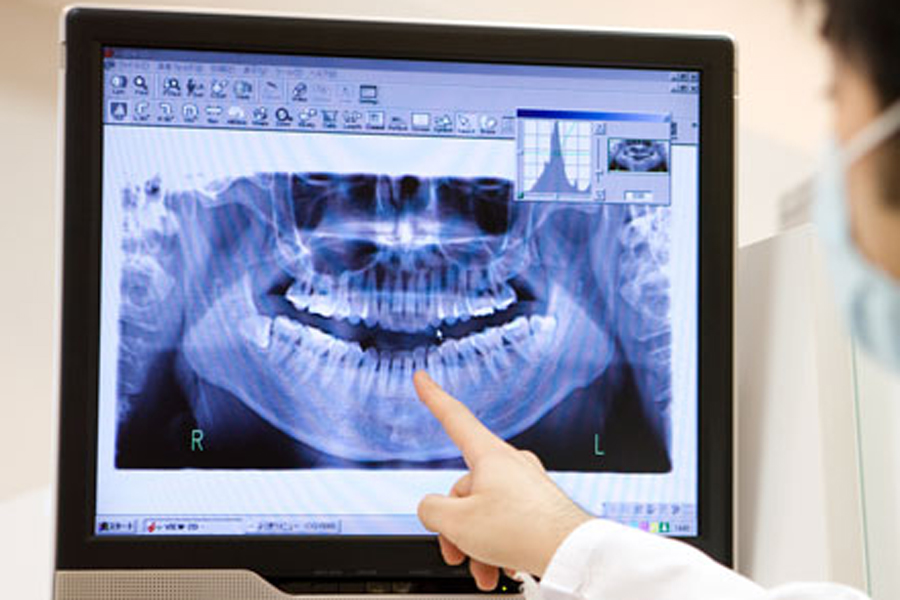 金沢文庫（横浜市金沢区）の歯医者、桜井歯科医院のお口の中のデキモノ