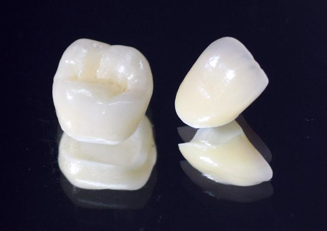 金沢文庫（横浜市金沢区）の歯医者、桜井歯科医院の審美歯科